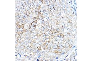 Immunohistochemistry (IHC) image for anti-Transmembrane Protease, serine 2 (TMPRSS2) (AA 140-400) antibody (ABIN6149286)