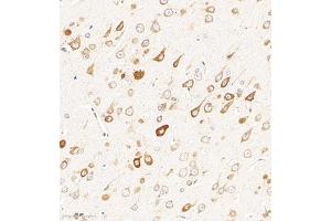 Immunohistochemistry of paraffin embedded rat brain using CHST6 (ABIN7073302) at dilution of 1:2000 (300x lens) (CHST6 抗体)