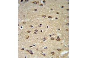 Immunohistochemistry (IHC) image for anti-delta-Like 2 Homolog (DLK2) antibody (ABIN3004005) (DLK2 抗体)