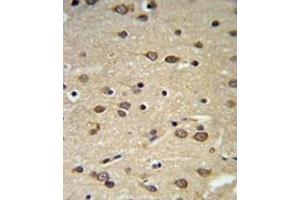 Immunohistochemistry (IHC) image for anti-delta-Like 2 Homolog (DLK2) antibody (ABIN3004005) (DLK2 抗体)