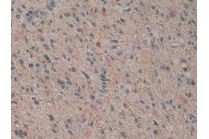 Immunohistochemistry (IHC) image for anti-Interleukin 12 alpha (IL12A) (AA 23-219) antibody (ABIN7428245)