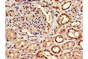 Immunohistochemistry of paraffin-embedded human kidney tissue using ABIN7147925 at dilution of 1:100 (CPSF6 抗体  (AA 186-226))