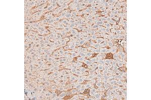 DF6386 at 1/200 staining mouse liver tissue sections by IHC-P. (Caveolin-1 抗体  (N-Term))