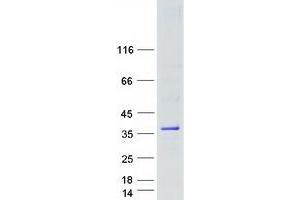 Western Blotting (WB) image for Oligodendrocyte Transcription Factor 1 (OLIG1) protein (Myc-DYKDDDDK Tag) (ABIN2727899)