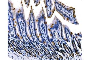 IHC analysis of Sigma1-Receptor/SIGMAR1 using anti-Sigma1-Receptor/SIGMAR1 antibody (ABIN7599011).