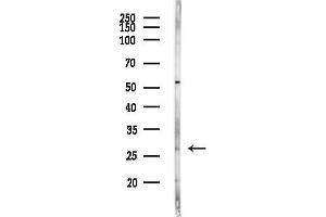 Western blot analysis of lysates from HepG2 cells(heat-shock,45 min treatment), using C1QA Antibody at 1/1000 dilution.