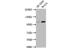 Western Blot Positive WB detected in: SH-SY5Y whole cell lysate, Rat brain tissue All lanes: LGR5 antibody at 1:1500 Secondary Goat polyclonal to rabbit IgG at 1/50000 dilution Predicted band size: 100, 98, 93 kDa Observed band size: 100 kDa (Recombinant LGR5 抗体)