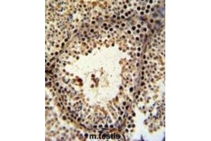 Immunohistochemistry (IHC) image for anti-PHD Finger Protein 13 (PHF13) antibody (ABIN3002222) (PHF13 抗体)