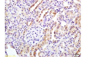 Formalin-fixed and paraffin embedded rat kidney labeled with Rabbit Anti APAF1 Polyclonal Antibody, Unconjugated (ABIN724295) at 1:200 followed by conjugation to the secondary antibody and DAB staining (APAF1 抗体  (AA 1201-1248))