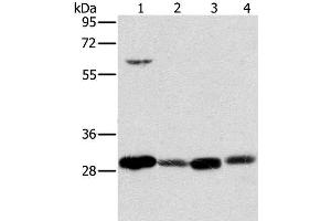 Western Blot analysis of 293T cell and Human testis tissue, A375 cell and Human normal kidney tissue using MRPL28 Polyclonal Antibody at dilution of 1:600 (MRPL28 抗体)