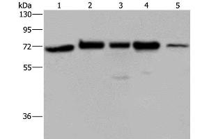 Western Blot analysis of A172, Hela and 293T cell, K562 cell and Human testis tissue using AGFG1 Polyclonal Antibody at dilution of 1:727 (AGFG1 抗体)