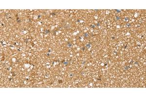 Immunohistochemistry of paraffin-embedded Human brain tissue using SDC3 Polyclonal Antibody at dilution 1:45 (SDC3 抗体)