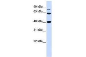 Image no. 1 for anti-Catenin (Cadherin-Associated Protein), beta 1, 88kDa (CTNNB1) (AA 684-733) antibody (ABIN6744377) (CTNNB1 抗体  (AA 684-733))