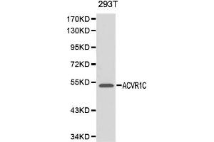 Western blot analysis of 293T cell lysate using ACVR1C antibody. (ACVR1C/ALK7 抗体  (AA 22-113))