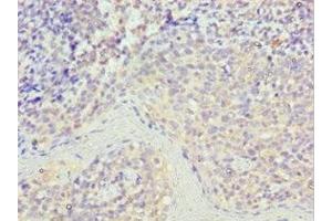 Immunohistochemistry of paraffin-embedded human tonsil tissue using ABIN7168977 at dilution of 1:100 (STK16 抗体  (AA 1-305))