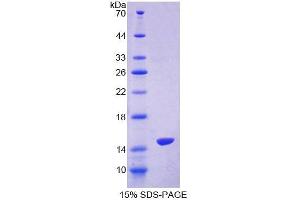 SDS-PAGE analysis of Human S100Z Protein.