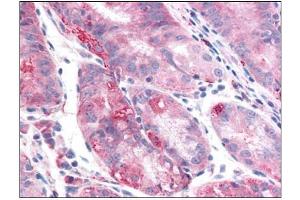 Human Stomach: Formalin-Fixed, Paraffin-Embedded (FFPE) (TMEM33 抗体)