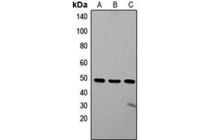 Western blot analysis of ZIC1/2/3 expression in SW480 (A), Jurkat (B), SHSY5Y (C) whole cell lysates. (ZIC1/2/3 抗体  (Center))