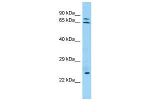 WB Suggested Anti-KRT74 Antibody Titration: 1. (KRT74 抗体  (N-Term))