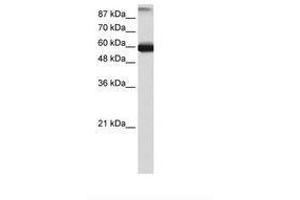 Image no. 2 for anti-General Transcription Factor IIIC, Polypeptide 5 (GTF3C5) (AA 148-197) antibody (ABIN6736178) (GTF3C5 抗体  (AA 148-197))