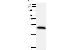 Western Blotting (WB) image for anti-Ankyrin Repeat Domain 11 (ANKRD11) antibody (ABIN933001) (ANKRD11 抗体)