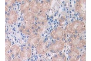 Detection of AHSG in Mouse Kidney Tissue using Polyclonal Antibody to Alpha-2-Heremans Schmid Glycoprotein (AHSG)