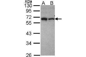 Western Blotting (WB) image for anti-Telomeric Repeat Binding Factor 2, Interacting Protein (TERF2IP) (Center) antibody (ABIN2855248)