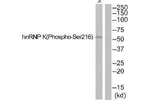 Western blot analysis of extracts from JurKat cells, using hnRNP K (Phospho-Ser216) antibody. (HNRNPK 抗体  (pSer216))