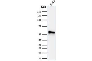 Western Blot Analysis of human HeLa cell lysate using Cytokeratin 7 Mouse Monoclonal Antibody (KRT7/760 + OV-TL12/30) (Cytokeratin 7 抗体)