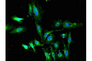 Immunofluorescent analysis of Hela cells using ABIN7164194 at dilution of 1:100 and Alexa Fluor 488-congugated AffiniPure Goat Anti-Rabbit IgG(H+L) (WTAP 抗体  (AA 1-151))