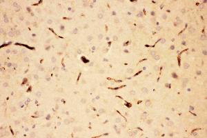 Anti-ACTH Picoband antibody, IHC(P): Rat Brain Tissue (POMC 抗体  (Middle Region))