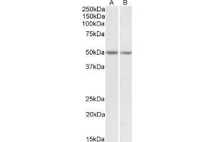 ABIN571171 (0. (GNAS 抗体  (Internal Region))