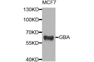 Western blot analysis of extracts of MCF-7 cells, using GBA antibody. (GBA 抗体  (AA 40-250))