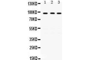 Western Blotting (WB) image for anti-K(lysine) Acetyltransferase 2A (KAT2A) (AA 75-106), (N-Term) antibody (ABIN3042472) (KAT2A 抗体  (N-Term))