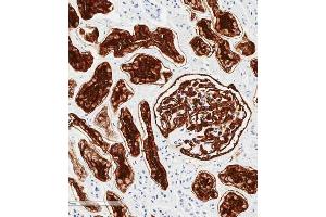 Immunohistochemical analysis of paraffin-embedded human kidney tissue using (ABIN6243087 and ABIN6577253) performed on the Leica® BOND RXm. (MME 抗体  (AA 472-505))