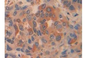 Immunohistochemistry (IHC) image for anti-Pyruvate Kinase, Liver and RBC (PKLR) (AA 219-420) antibody (ABIN7431302)
