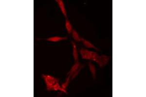 ABIN6274750 staining Hela cells by IF/ICC. (RPS18 抗体)