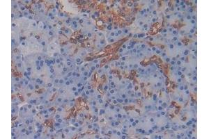 Detection of AMH in Human Pancreas Tissue using Monoclonal Antibody to Anti-Mullerian Hormone (AMH) (AMH 抗体)
