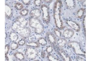 Detection of ICA1 in Human Kidney Tissue using Monoclonal Antibody to Islet Cell Autoantigen 1 (ICA1) (ICA1 抗体  (AA 1-258))