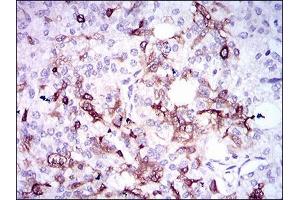 Immunohistochemistry (IHC) image for anti-Secreted phosphoprotein 1 (SPP1) (AA 167-314) antibody (ABIN1098149)