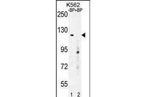 Western blot analysis of DEPD5 Antibody Pab pre-incubated without(lane 1) and with(lane 2) blocking peptide in K562 cell line lysate. (DEPDC5 抗体  (C-Term))