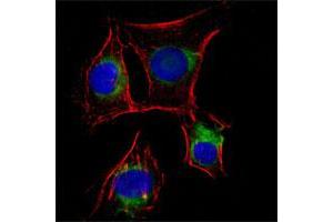 Immunofluorescence analysis of EC cells (rat aortic endothelial cells) using NGFR monoclonal antibody, clone 2F1C2  (green). (NGFR 抗体)