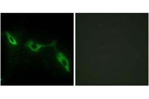 Immunofluorescence analysis of NIH-3T3 cells, using LEG9 Antibody. (Galectin 9 抗体  (AA 51-100))