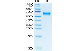 Biotinylated Human IL-3 R alpha on Tris-Bis PAGE under reduced condition. (IL3RA Protein (AA 19-305) (His-Avi Tag,Biotin))