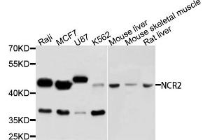 Western blot analysis of extracts of various cell lines, using NCR2 antibody (ABIN5995548) at 1/1000 dilution. (NKp44/NCR2 抗体)