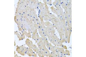 Immunohistochemistry of paraffin-embedded rat heart using GPLD1 antibody at dilution of 1:100 (40x lens). (GPLD1 抗体)
