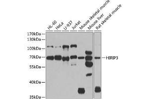 HIRIP3 抗体  (AA 417-556)