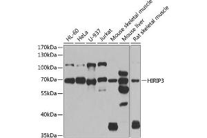 Western blot analysis of extracts of various cell lines, using HIRIP3 antibody (ABIN6128019, ABIN6141779, ABIN6141780 and ABIN6222788) at 1:1000 dilution. (HIRIP3 抗体  (AA 417-556))