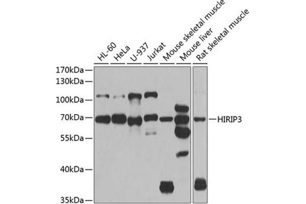 HIRIP3 抗体  (AA 417-556)