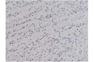 ABIN6256754 and ABIN6267331 at 1/200 staining Rat ganstric tissue sections by IHC-P. (LYN 抗体  (pTyr508))